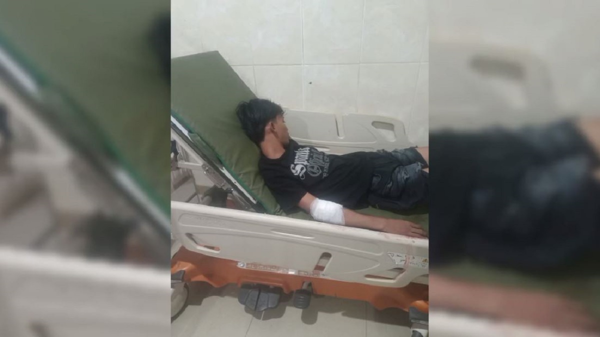Seorang Pelajar Dibacok Orang Tidak Dikenal di Kawasan Perkantoran Gubernur