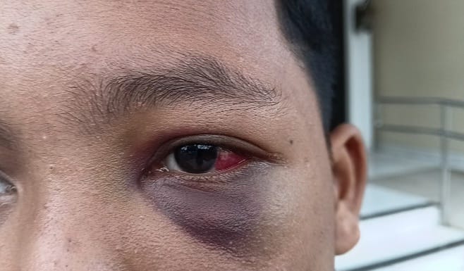Diduga Aniaya Santri, Oknum Ustadz Pesantren di Muaro Jambi Dipolisikan 