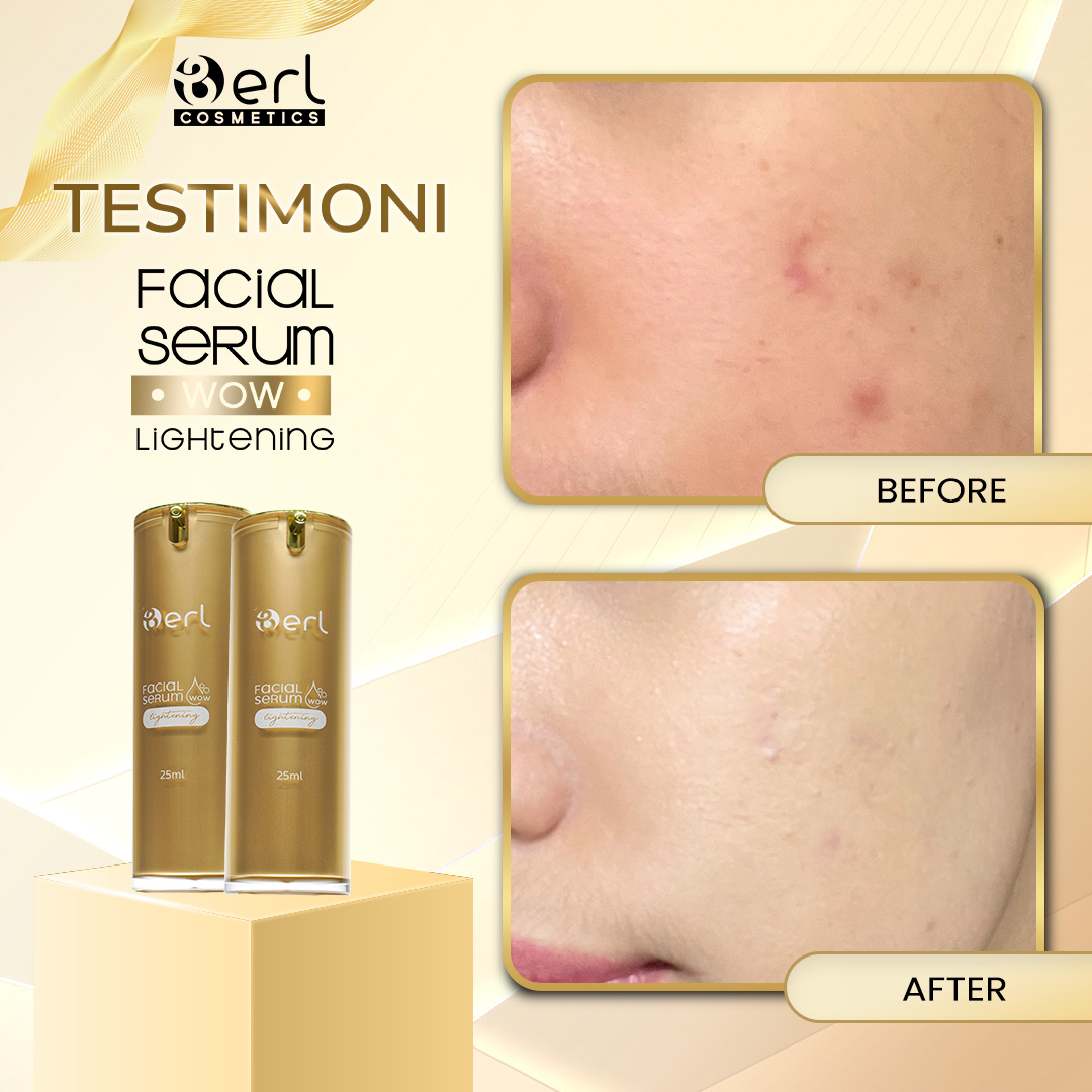 Skincare Serum Pencerah Wajah yang Aman di Kulit, Wajah Bebas Kusam dengan B Erl WoW Lightening Facial Serum 