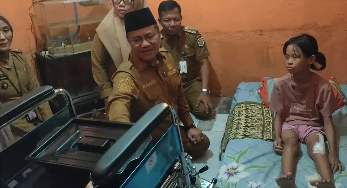 Berjuang Melawan Tumor Tulang, Mira Siswi SMP di Jambi Dapat Dukungan dari Wali Kota