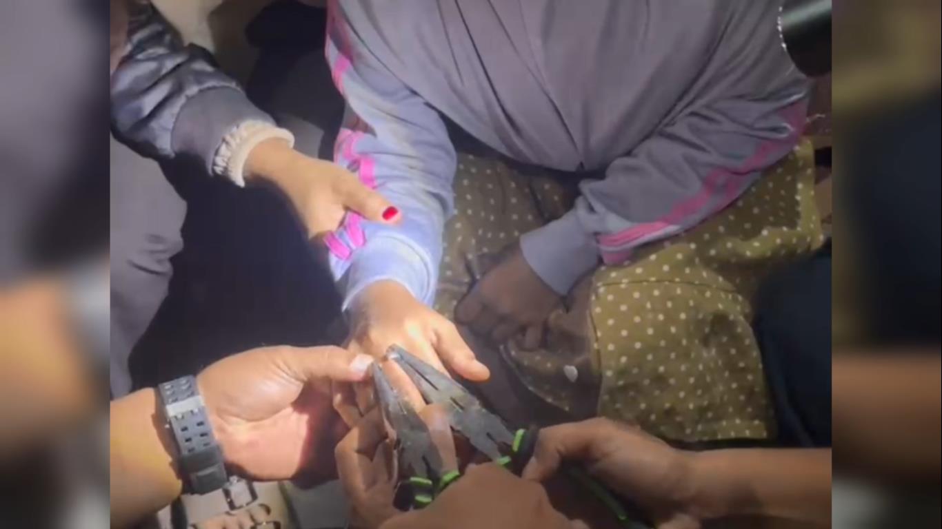 Cincin Tak Bisa Lepas, Seorang Siswi SD Minta Bantu Petugas Damkarmat