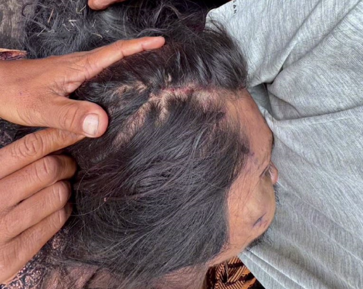 Melawan Petugas Saat Ditangkap, Seorang Bandar Narkoba Di Tebo Tewas Tertembak Dibagian Kaki