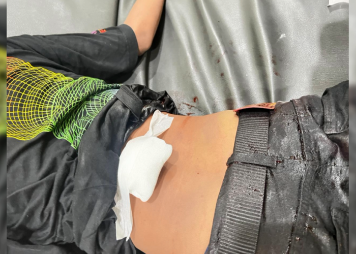 Pemuda Dibacok di Lebak Bandung, Diduga Ulah Geng Motor