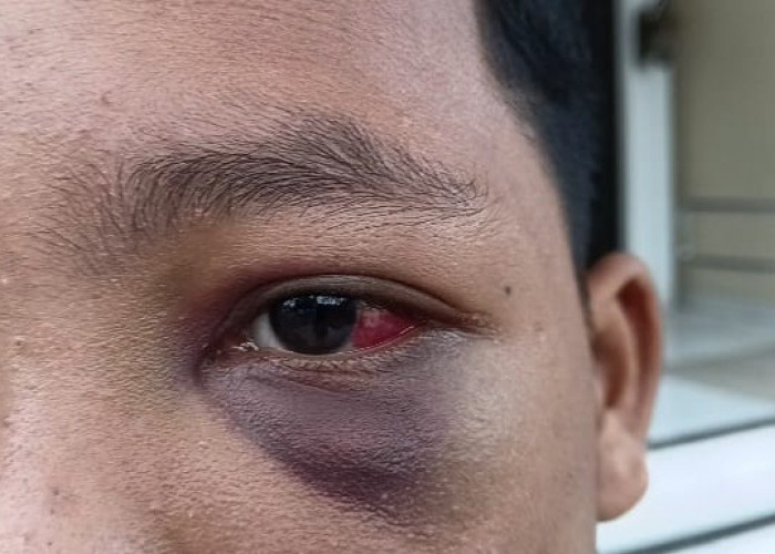 Diduga Aniaya Santri, Oknum Ustadz Pesantren di Muaro Jambi Dipolisikan 