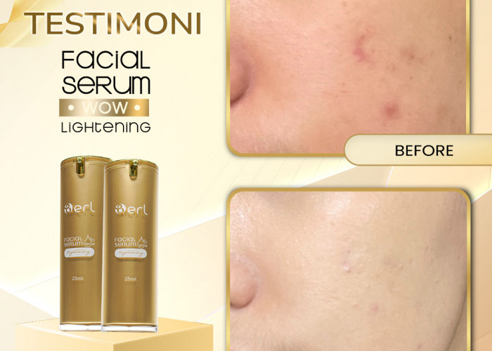 Skincare Serum Pencerah Wajah yang Aman di Kulit, Wajah Bebas Kusam dengan B Erl WoW Lightening Facial Serum 
