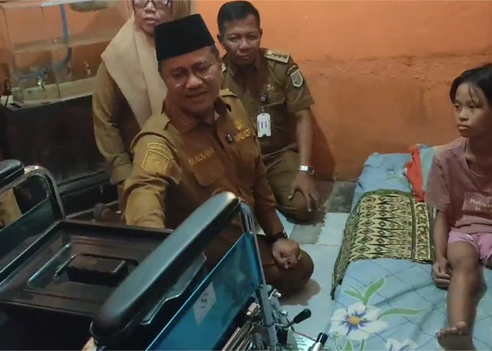 Berjuang Melawan Tumor Tulang, Mira Siswi SMP di Jambi Dapat Dukungan dari Wali Kota