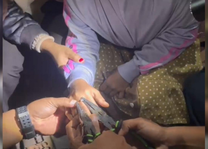 Cincin Tak Bisa Lepas, Seorang Siswi SD Minta Bantu Petugas Damkarmat