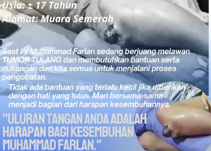 Muhammad Farlan, Remaja 17 Tahun di Muara Semerah Berjuang Melawan Tumor Tulang