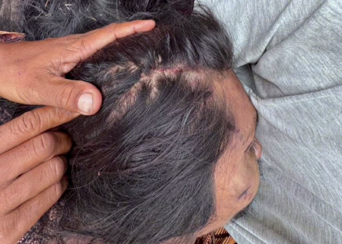 Melawan Petugas Saat Ditangkap, Seorang Bandar Narkoba Di Tebo Tewas Tertembak Dibagian Kaki