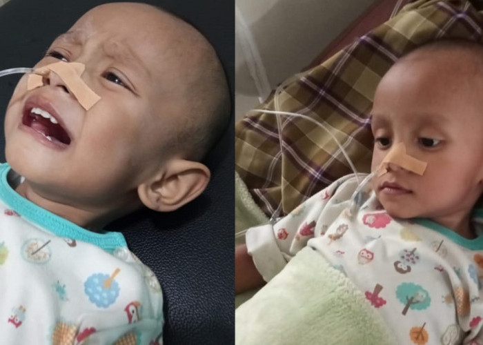 Balita 2 Tahun Asal Pondok Tinggi Berjuang Melawan Sakit, Keluarga Tak Mampu Biayai Pengobatan