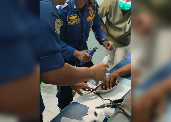 Cincin Tak Bisa Dilepas, Petugas Damkarmat Evakuasi Pemuda di Muara Bulian