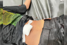 Pemuda Dibacok di Lebak Bandung, Diduga Ulah Geng Motor