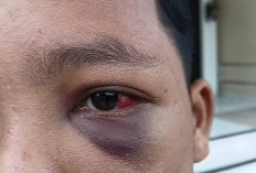 Diduga Aniaya Santri, Oknum Ustadz Pesantren di Muaro Jambi Dipolisikan 