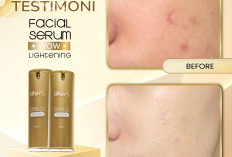 Skincare Serum Pencerah Wajah yang Aman di Kulit, Wajah Bebas Kusam dengan B Erl WoW Lightening Facial Serum 